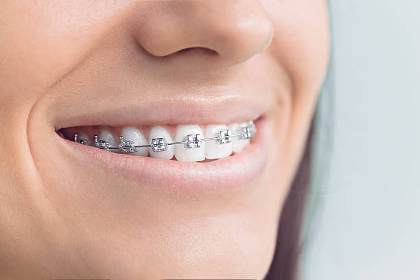 Best Sedation Dentistry  in Universal City, TX